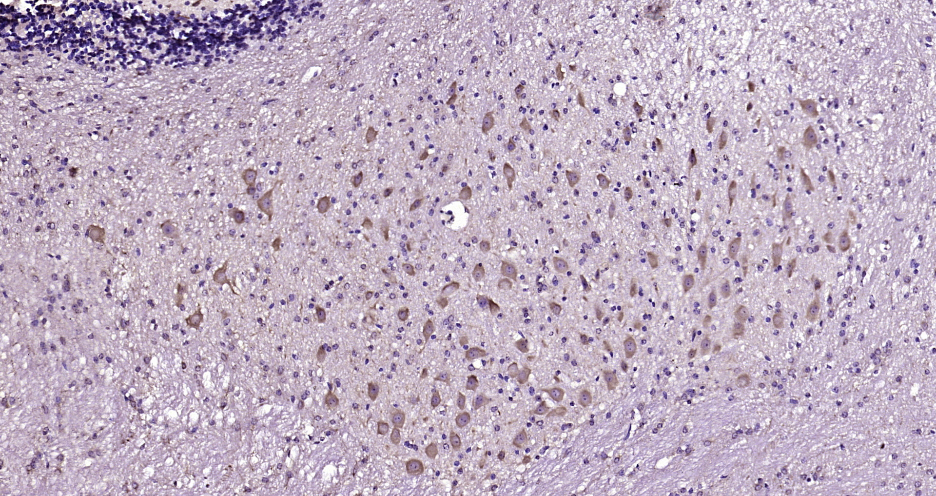 Paraformaldehyde-fixed, paraffin embedded Mouse cerebellum; Antigen retrieval by boiling in sodium citrate buffer (pH6.0) for 15min; Block endogenous peroxidase by 3% hydrogen peroxide for 20 minutes; Blocking buffer (normal goat serum) at 37°C for 30min; Antibody incubation with PCP4/PEP-19 Polyclonal Antibody, Unconjugated (bs-11326R) at 1:200 overnight at 4°C, DAB staining. Paraformaldehyde-fixed, paraffin embedded Mouse cerebellum; Antigen retrieval by boiling in sodium citrate buffer (pH6.0) for 15min; Block endogenous peroxidase by 3% hydrogen peroxide for 20 minutes; Blocking buffer (normal goat serum) at 37°C for 30min; Antibody incubation with PCP4/PEP-19 Polyclonal Antibody, Unconjugated (bs-11326R) at 1:200 overnight at 4°C, DAB staining.