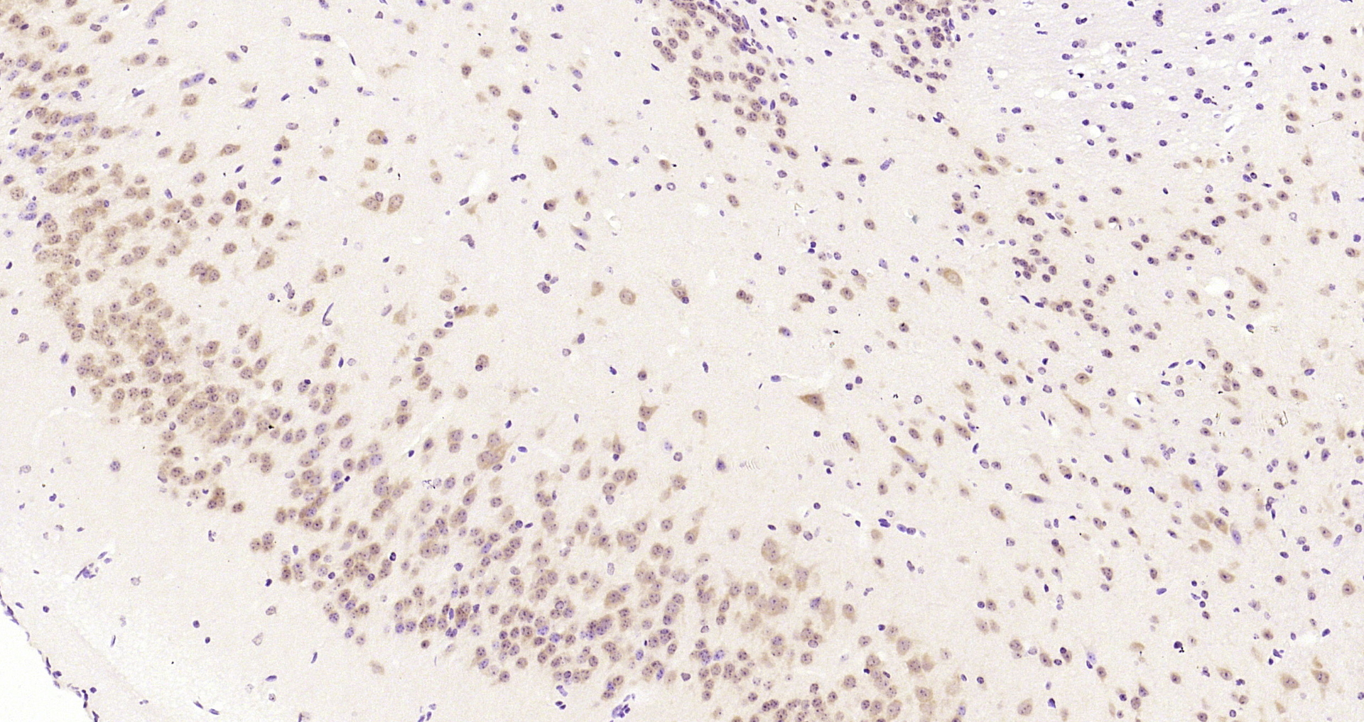 Paraformaldehyde-fixed, paraffin embedded Rat brain; Antigen retrieval by boiling in sodium citrate buffer (pH6.0) for 15min; Block endogenous peroxidase by 3% hydrogen peroxide for 20 minutes; Blocking buffer (normal goat serum) at 37°C for 30min; Antibody incubation with BBS1 Polyclonal Antibody, Unconjugated (bs-11507R) at 1:200 overnight at 4°C, DAB staining.