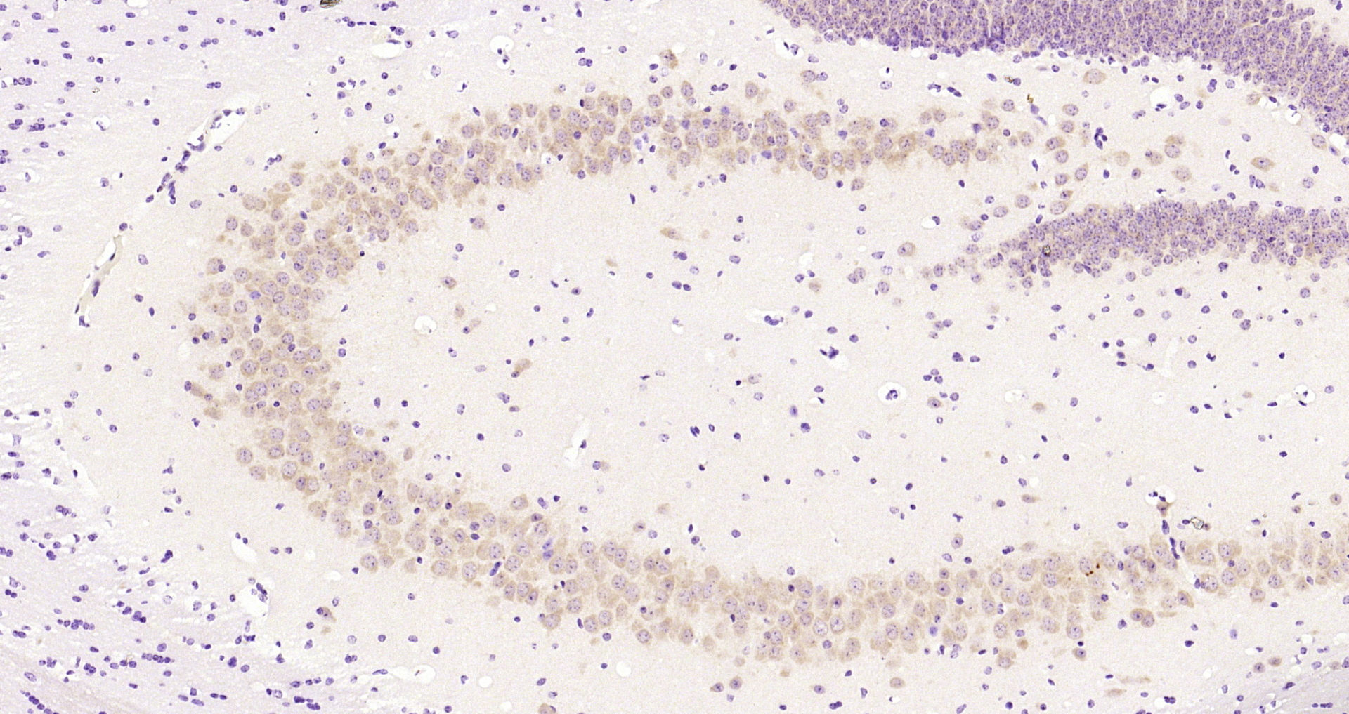 Paraformaldehyde-fixed, paraffin embedded Mouse brain; Antigen retrieval by boiling in sodium citrate buffer (pH6.0) for 15min; Block endogenous peroxidase by 3% hydrogen peroxide for 20 minutes; Blocking buffer (normal goat serum) at 37°C for 30min; Antibody incubation with BBS1 Polyclonal Antibody, Unconjugated (bs-11507R) at 1:200 overnight at 4°C, DAB staining.