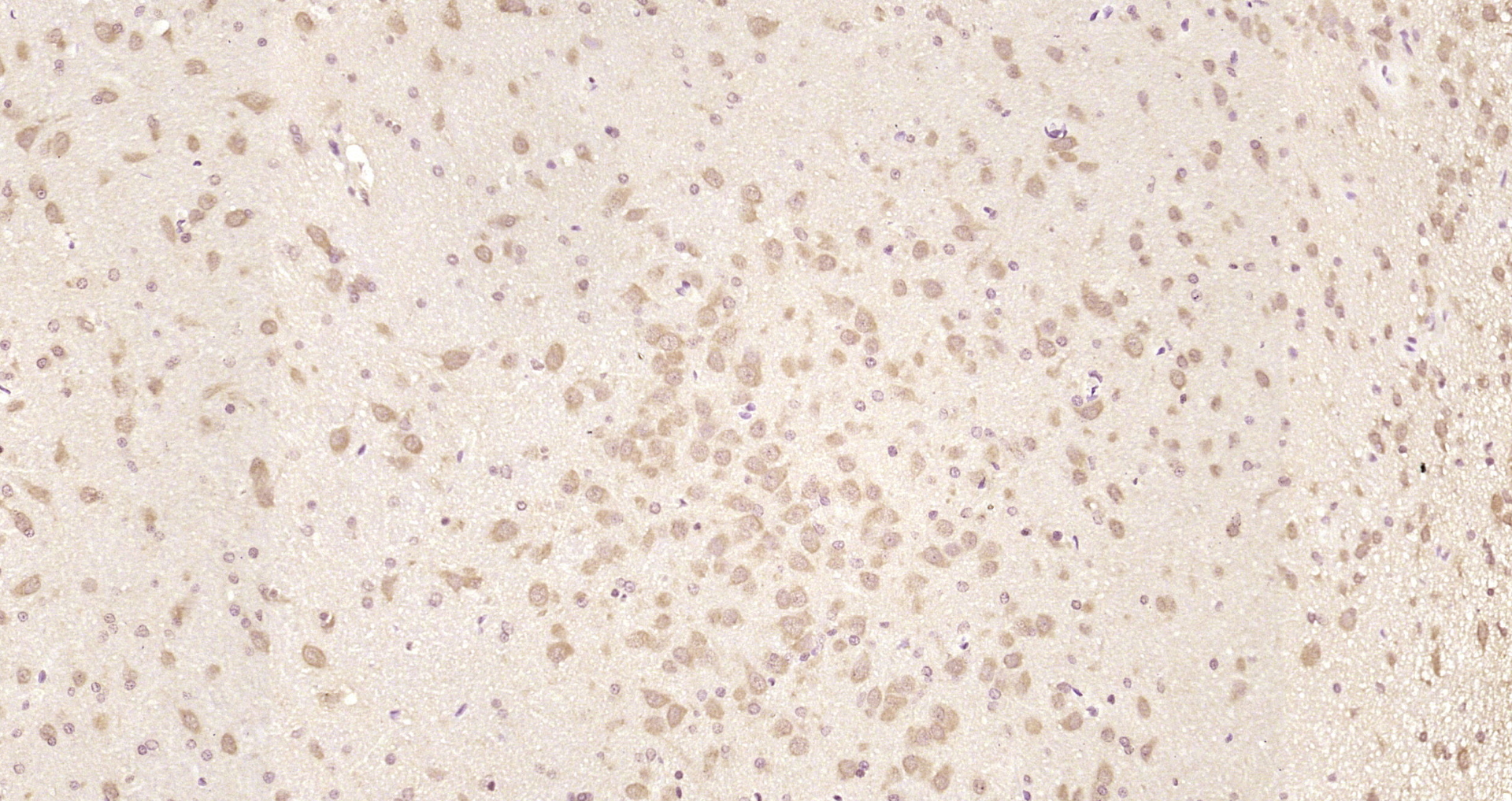 Paraformaldehyde-fixed, paraffin embedded Rat brain; Antigen retrieval by boiling in sodium citrate buffer (pH6.0) for 15min; Block endogenous peroxidase by 3% hydrogen peroxide for 20 minutes; Blocking buffer (normal goat serum) at 37°C for 30min; Antibody incubation with PICALM/CALM Polyclonal Antibody, Unconjugated (bs-11665R) at 1:200 overnight at 4°C, DAB staining.