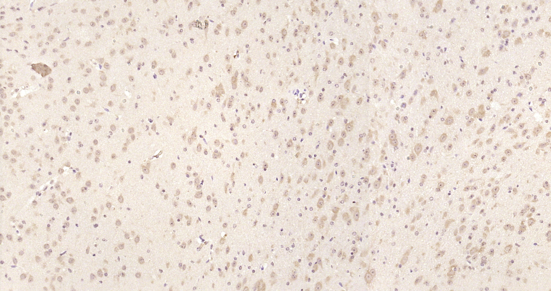 Paraformaldehyde-fixed, paraffin embedded Mouse brain; Antigen retrieval by boiling in sodium citrate buffer (pH6.0) for 15min; Block endogenous peroxidase by 3% hydrogen peroxide for 20 minutes; Blocking buffer (normal goat serum) at 37°C for 30min; Antibody incubation with PICALM/CALM Polyclonal Antibody, Unconjugated (bs-11665R) at 1:200 overnight at 4°C, DAB staining.