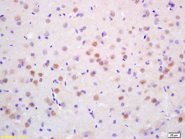 Formalin-fixed and paraffin embedded rat brain labeled with Rabbit Anti CDC10/Septin 7 Polyclonal Antibody, Unconjugated (bs-7741R) at 1:200 followed by conjugation to the secondary antibody and DAB staining