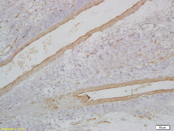 Formalin-fixed and paraffin embedded rat embryonic rhabdomyoma labeled with Anti-MyoD1/Myf3 Polyclonal Antibody, Unconjugated (bs-2442R) at 1:200 followed by conjugation to the secondary antibody