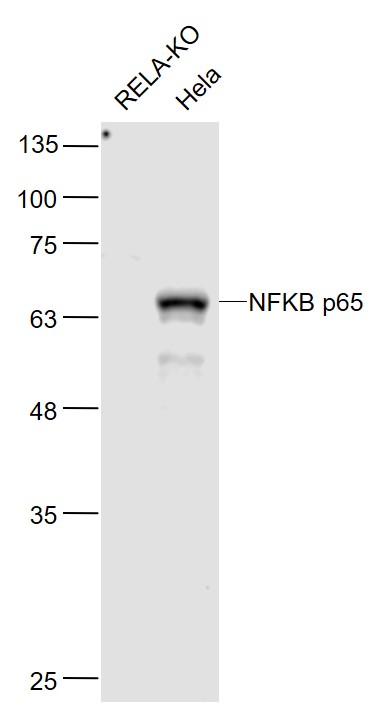 Lane 1: RELE-KO cell lysates; Lane 2: Hela cell lysates probed with NFKB p65 Monoclonal Antibody, Unconjugated (bsm-33117M) at 1:1000 dilution and 4˚C overnight incubation. Followed by conjugated secondary antibody incubation at 1:20000 for 60 min at 37˚C.