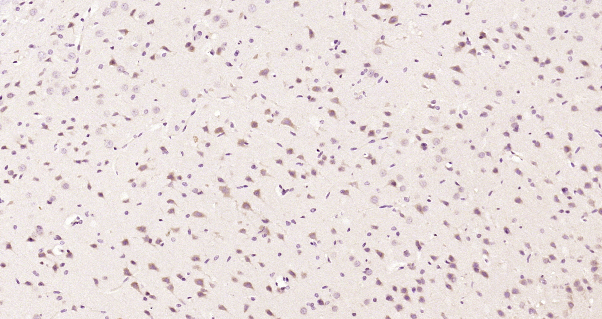 Paraformaldehyde-fixed, paraffin embedded Rat brain; Antigen retrieval by boiling in sodium citrate buffer (pH6.0) for 15min; Block endogenous peroxidase by 3% hydrogen peroxide for 20 minutes; Blocking buffer (normal goat serum) at 37°C for 30min; Antibody incubation with ATF2 (Thr55) Polyclonal Antibody, Unconjugated (bs-12539R) at 1:200 overnight at 4°C, DAB staining.