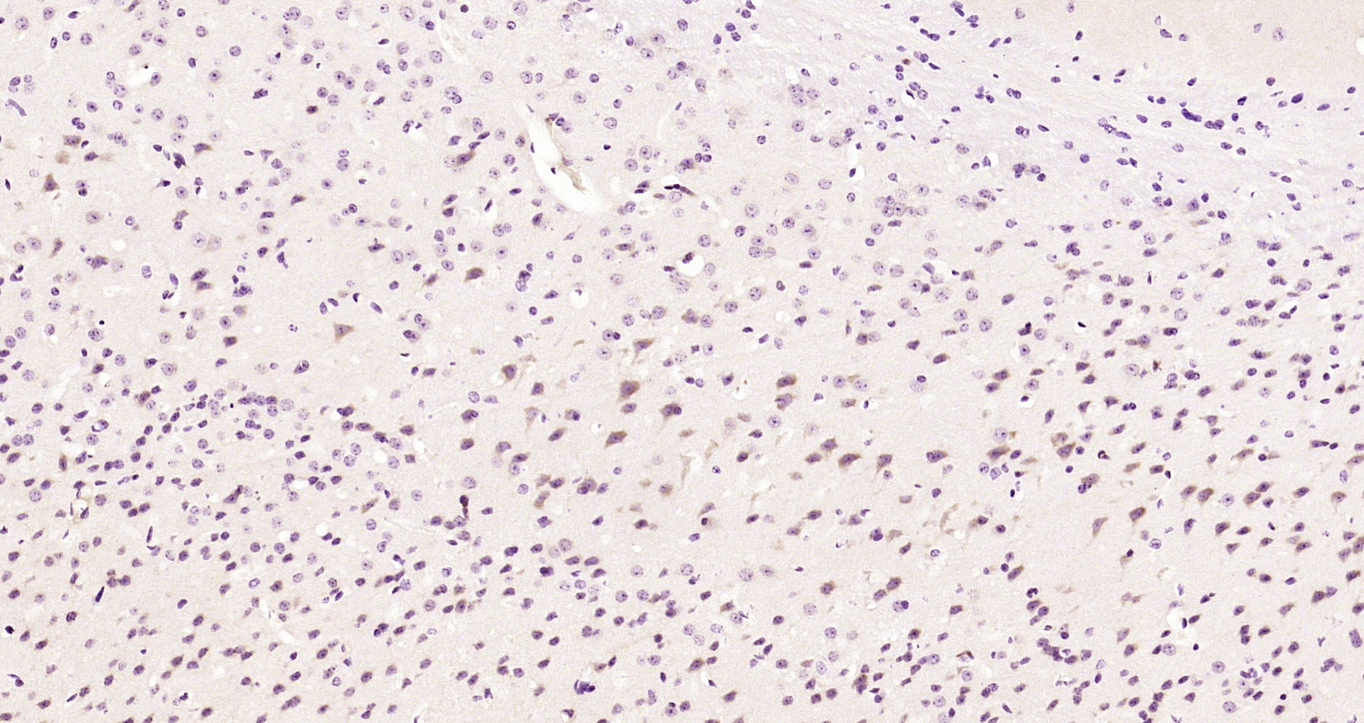 Paraformaldehyde-fixed, paraffin embedded Mouse brain; Antigen retrieval by boiling in sodium citrate buffer (pH6.0) for 15min; Block endogenous peroxidase by 3% hydrogen peroxide for 20 minutes; Blocking buffer (normal goat serum) at 37°C for 30min; Antibody incubation with ATF2 (Thr55) Polyclonal Antibody, Unconjugated (bs-12539R) at 1:200 overnight at 4°C, DAB staining.