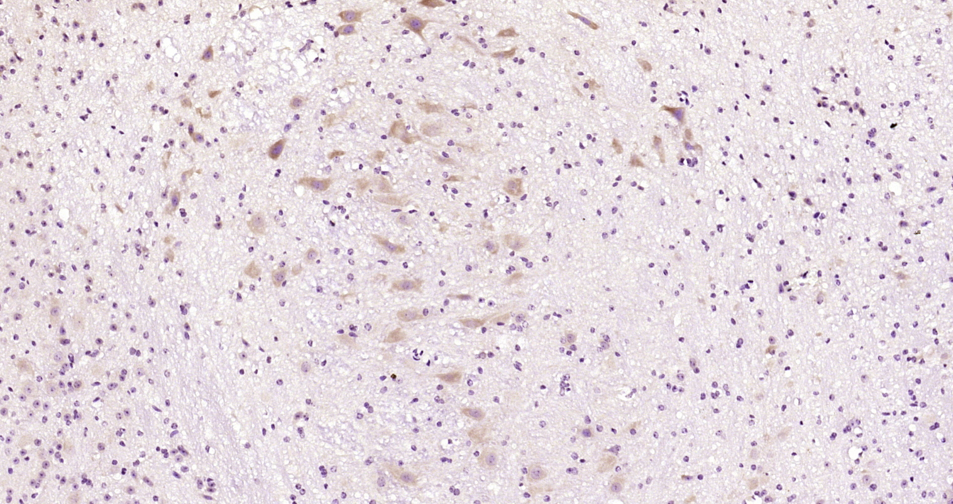 Paraformaldehyde-fixed, paraffin embedded Mouse cerebellum; Antigen retrieval by boiling in sodium citrate buffer (pH6.0) for 15min; Block endogenous peroxidase by 3% hydrogen peroxide for 20 minutes; Blocking buffer (normal goat serum) at 37°C for 30min; Antibody incubation with ATF2 (Thr55) Polyclonal Antibody, Unconjugated (bs-12539R) at 1:200 overnight at 4°C, DAB staining.