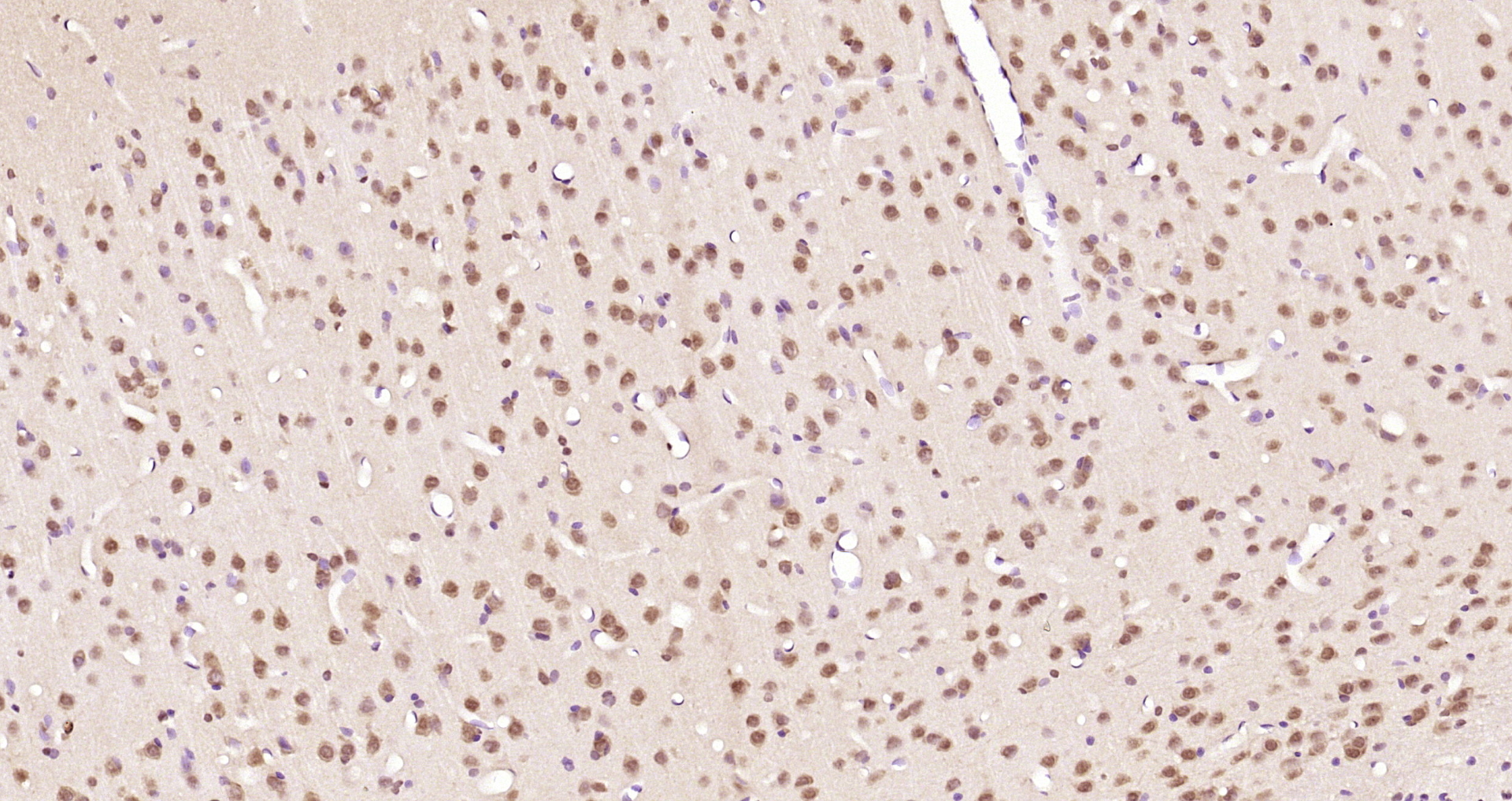 Paraformaldehyde-fixed, paraffin embedded Rat brain; Antigen retrieval by boiling in sodium citrate buffer (pH6.0) for 15min; Block endogenous peroxidase by 3% hydrogen peroxide for 20 minutes; Blocking buffer (normal goat serum) at 37°C for 30min; Antibody incubation with DYX1C1 Polyclonal Antibody, Unconjugated (bs-13043R) at 1:200 overnight at 4°C, DAB staining.