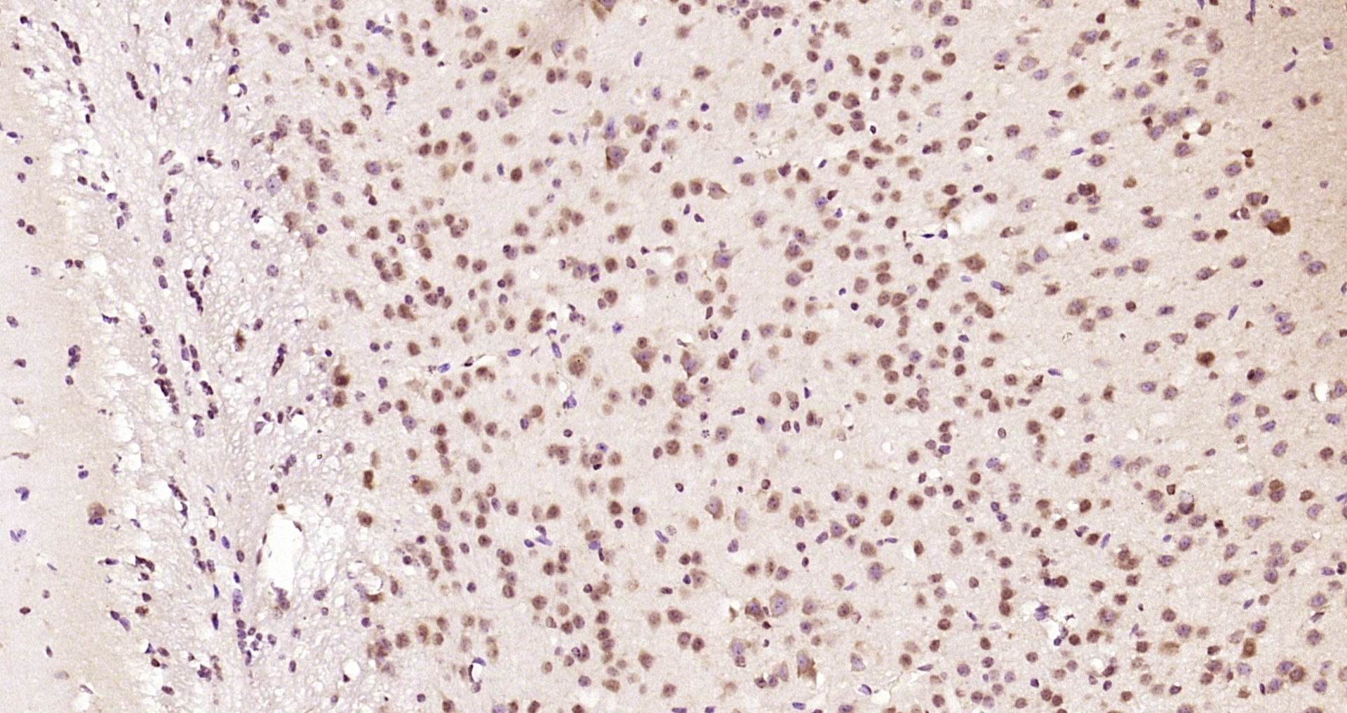 Paraformaldehyde-fixed, paraffin embedded Mouse brain; Antigen retrieval by boiling in sodium citrate buffer (pH6.0) for 15min; Block endogenous peroxidase by 3% hydrogen peroxide for 20 minutes; Blocking buffer (normal goat serum) at 37°C for 30min; Antibody incubation with DYX1C1 Polyclonal Antibody, Unconjugated (bs-13043R) at 1:200 overnight at 4°C, DAB staining.