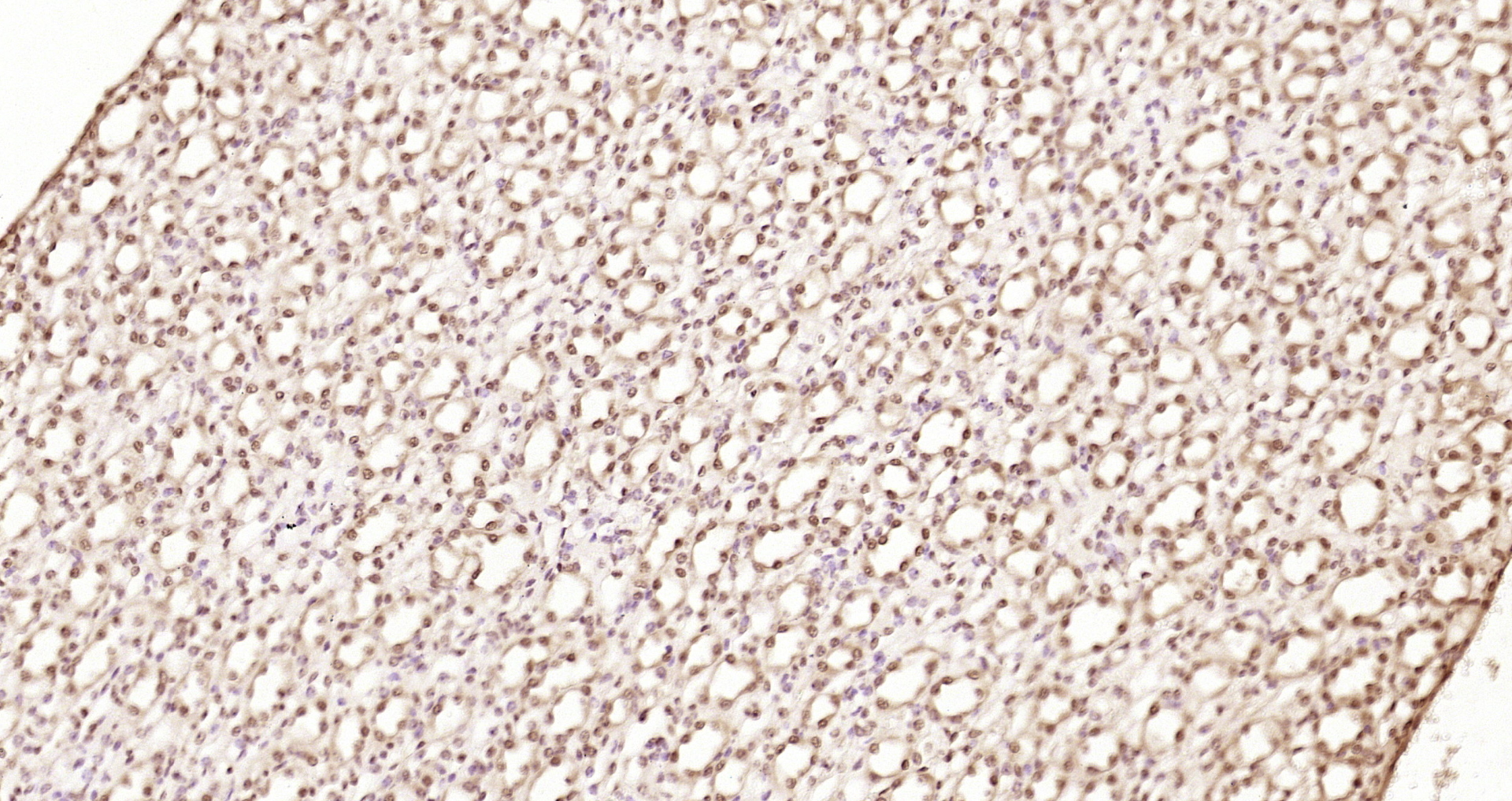 Paraformaldehyde-fixed, paraffin embedded Mouse kidney; Antigen retrieval by boiling in sodium citrate buffer (pH6.0) for 15min; Block endogenous peroxidase by 3% hydrogen peroxide for 20 minutes; Blocking buffer (normal goat serum) at 37°C for 30min; Antibody incubation with DYX1C1 Polyclonal Antibody, Unconjugated (bs-13043R) at 1:200 overnight at 4°C, DAB staining.