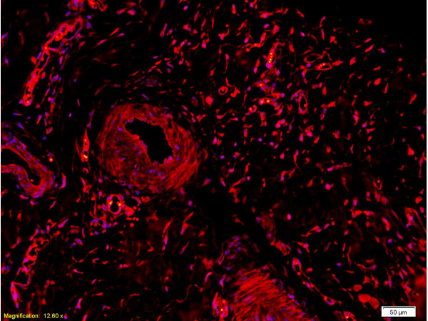 Formalin-fixed and paraffin embedded rabbit meniscus tissue labeled Anti-Collagen II Polyclonal Antibody, Unconjugated (bs-0709R) at 1:200, followed by conjugation to the secondary Goat Anti-Rabbit IgG, Cy3 conjugated (bs-0295G-Cy3)used at 1:200 dilution for 40 minutes at 37°C. and DAPI