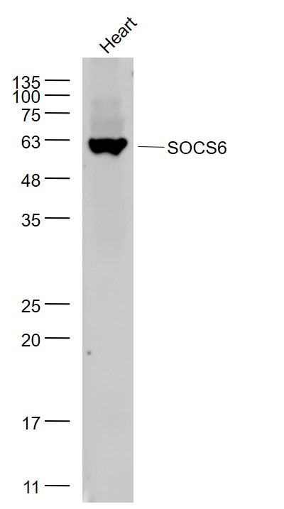 Lane 1: Chicken Heart lysates probed with SOCS6 Polyclonal Antibody, Unconjugated (bs-10685R) at 1:1000 dilution and 4˚C overnight incubation. Followed by conjugated secondary antibody incubation at 1:20000 for 60 min at 37˚C.