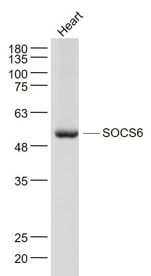 Lane 1: Mouse Heart lysates probed with SOCS6 Polyclonal Antibody, Unconjugated (bs-10685R) at 1:1000 dilution and 4˚C overnight incubation. Followed by conjugated secondary antibody incubation at 1:20000 for 60 min at 37˚C.