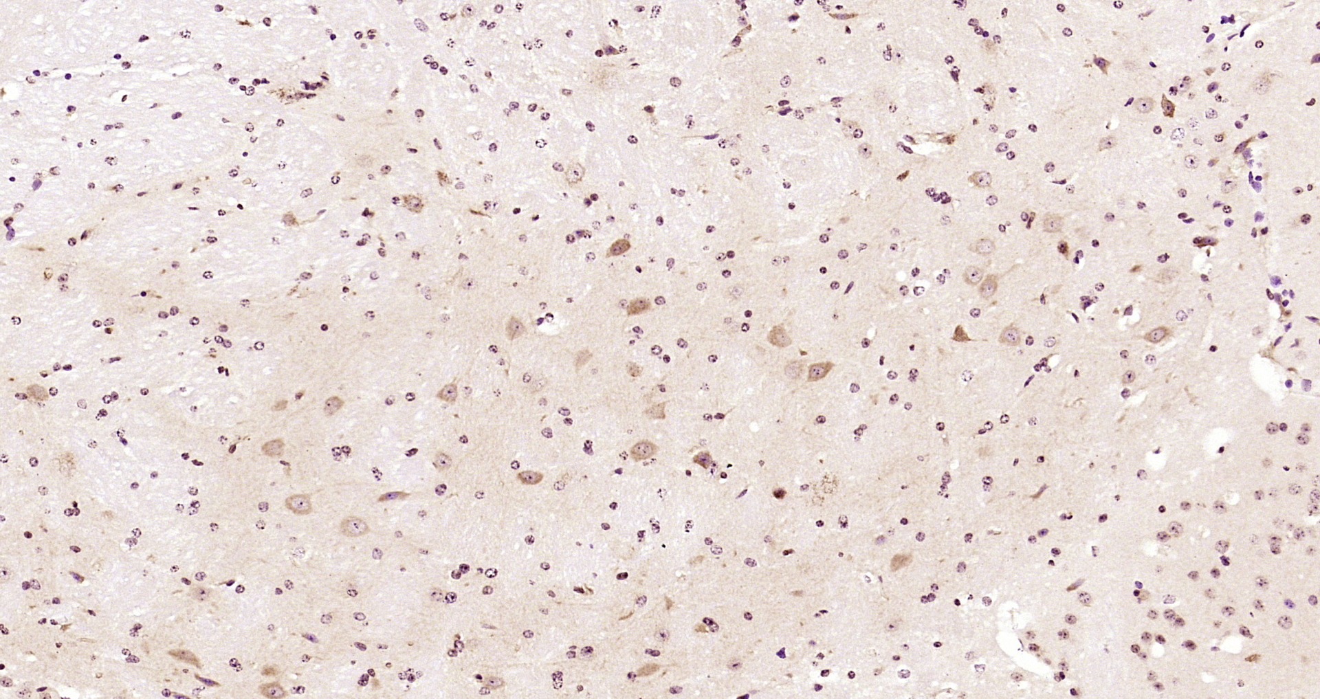 Paraformaldehyde-fixed, paraffin embedded Mouse brain; Antigen retrieval by boiling in sodium citrate buffer (pH6.0) for 15min; Block endogenous peroxidase by 3% hydrogen peroxide for 20 minutes; Blocking buffer (normal goat serum) at 37°C for 30min; Antibody incubation with Glutamyl Prolyl tRNA synthetase Polyclonal Antibody, Unconjugated (bs-13393R) at 1:200 overnight at 4°C, DAB staining.
