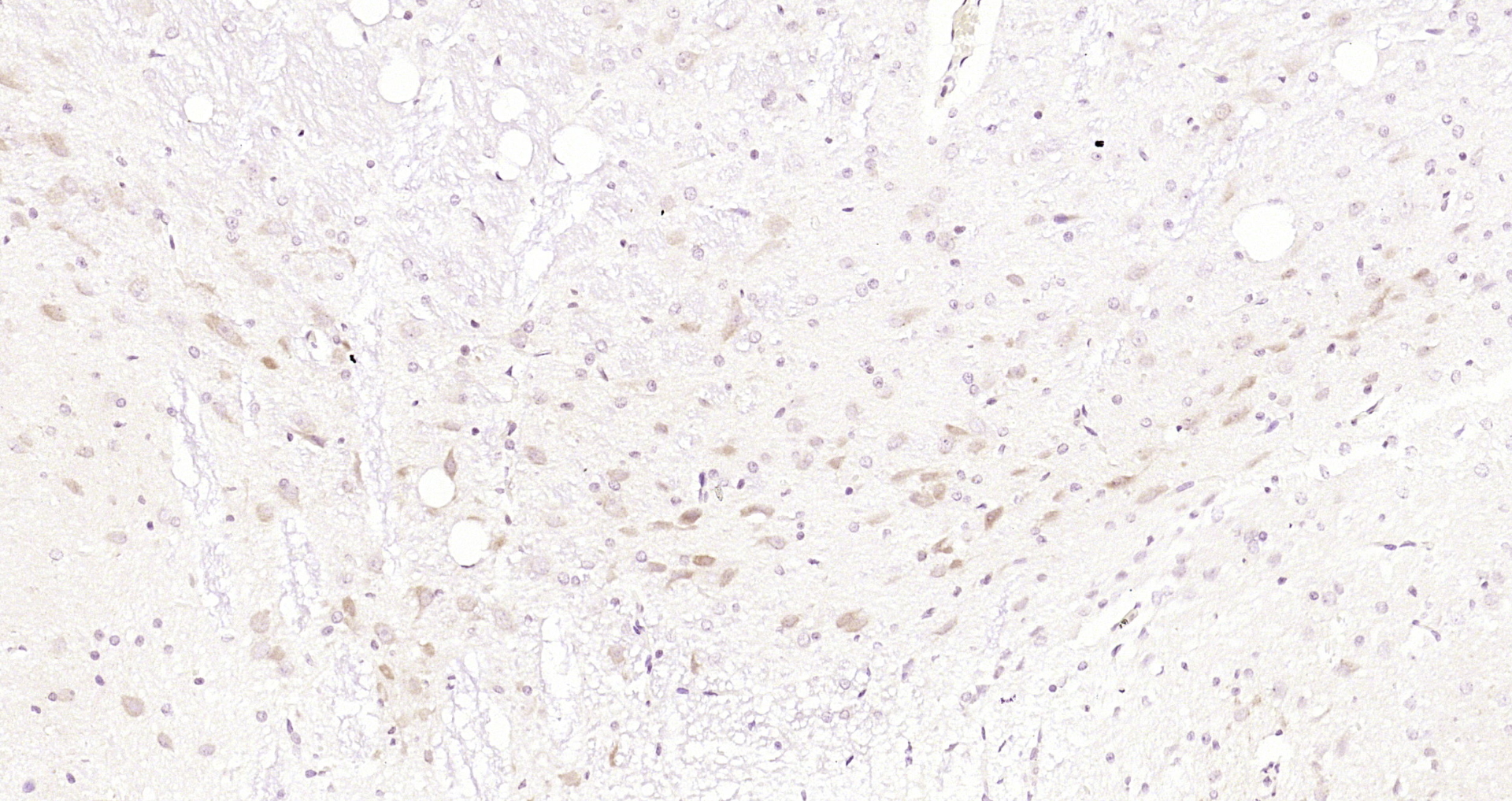 Paraformaldehyde-fixed, paraffin embedded Rat brain; Antigen retrieval by boiling in sodium citrate buffer (pH6.0) for 15min; Block endogenous peroxidase by 3% hydrogen peroxide for 20 minutes; Blocking buffer (normal goat serum) at 37°C for 30min; Antibody incubation with GNPDA2 Polyclonal Antibody, Unconjugated (bs-13474R) at 1:200 overnight at 4°C, DAB staining. Paraformaldehyde-fixed, paraffin embedded Rat brain; Antigen retrieval by boiling in sodium citrate buffer (pH6.0) for 15min; Block endogenous peroxidase by 3% hydrogen peroxide for 20 minutes; Blocking buffer (normal goat serum) at 37°C for 30min; Antibody incubation with GNPDA2 Polyclonal Antibody, Unconjugated (bs-13474R) at 1:200 overnight at 4°C, DAB staining.