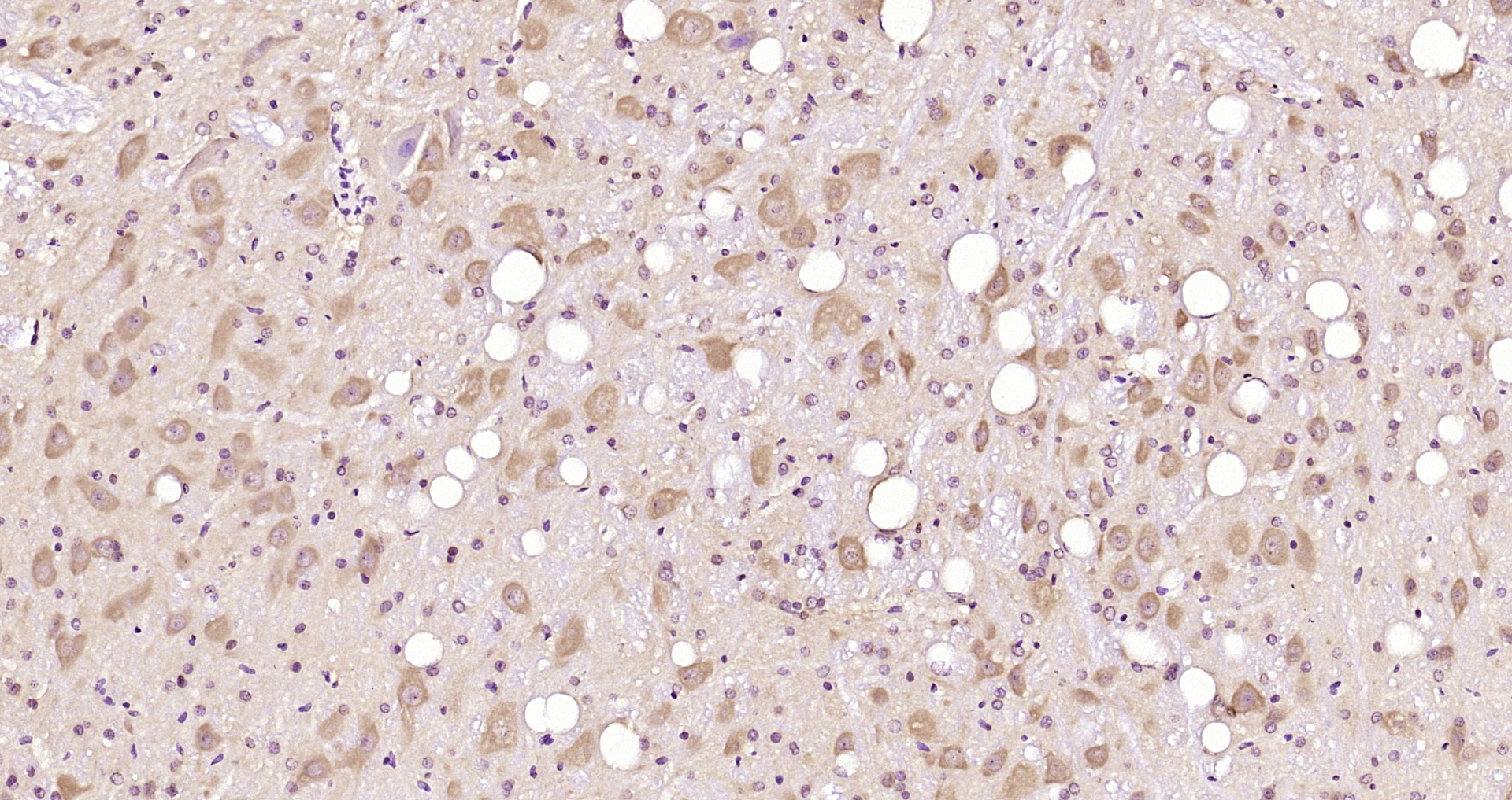 Paraformaldehyde-fixed, paraffin embedded Rat brain; Antigen retrieval by boiling in sodium citrate buffer (pH6.0) for 15min; Block endogenous peroxidase by 3% hydrogen peroxide for 20 minutes; Blocking buffer (normal goat serum) at 37°C for 30min; Antibody incubation with GOSR1/GS28 Polyclonal Antibody, Unconjugated (bs-13493R) at 1:200 overnight at 4°C, DAB staining.