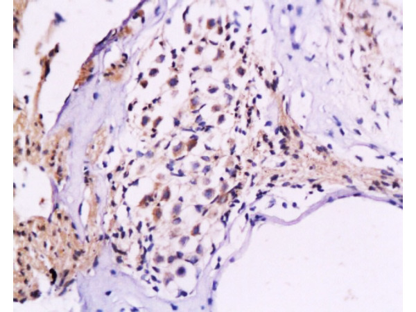 Formalin-fixed and paraffin embedded rat cochlea tissue labeled Anti-NF-M/Neurofilament M Polyclonal Antibody, Unconjugated (bs-0710R) at 1:200, followed by conjugation to the secondary antibody and DAB staining