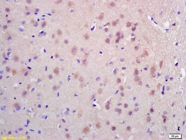 Formalin-fixed and paraffin embedded rat brain labeled with Rabbit Anti CDC45L Polyclonal Antibody, Unconjugated (bs-7785R) at 1:200 followed by conjugation to the secondary antibody and DAB staining