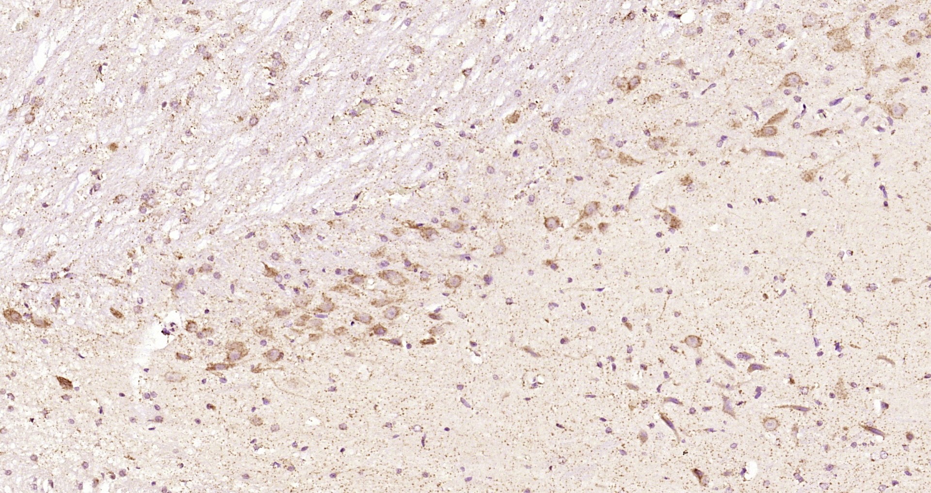 Paraformaldehyde-fixed, paraffin embedded Rat brain; Antigen retrieval by boiling in sodium citrate buffer (pH6.0) for 15min; Block endogenous peroxidase by 3% hydrogen peroxide for 20 minutes; Blocking buffer (normal goat serum) at 37°C for 30min; Antibody incubation with ELP4 Polyclonal Antibody, Unconjugated (bs-14574R) at 1:200 overnight at 4°C, DAB staining.