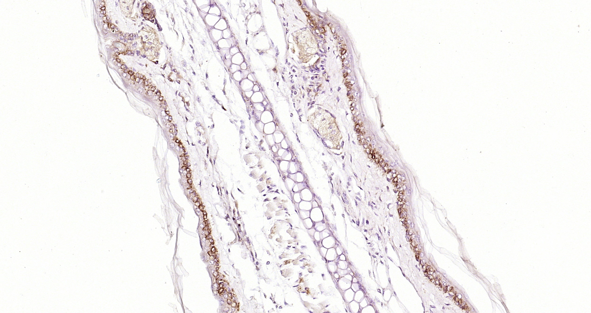 Paraformaldehyde-fixed, paraffin embedded Mouse skin; Antigen retrieval by boiling in sodium citrate buffer (pH6.0) for 15min; Block endogenous peroxidase by 3% hydrogen peroxide for 20 minutes; Blocking buffer (normal goat serum) at 37°C for 30min; Antibody incubation with p21-ARC Polyclonal Antibody, Unconjugated (bs-17589R) at 1:200 overnight at 4°C, DAB staining. Paraformaldehyde-fixed, paraffin embedded Mouse skin; Antigen retrieval by boiling in sodium citrate buffer (pH6.0) for 15min; Block endogenous peroxidase by 3% hydrogen peroxide for 20 minutes; Blocking buffer (normal goat serum) at 37°C for 30min; Antibody incubation with p21-ARC Polyclonal Antibody, Unconjugated (bs-17589R) at 1:200 overnight at 4°C, DAB staining.