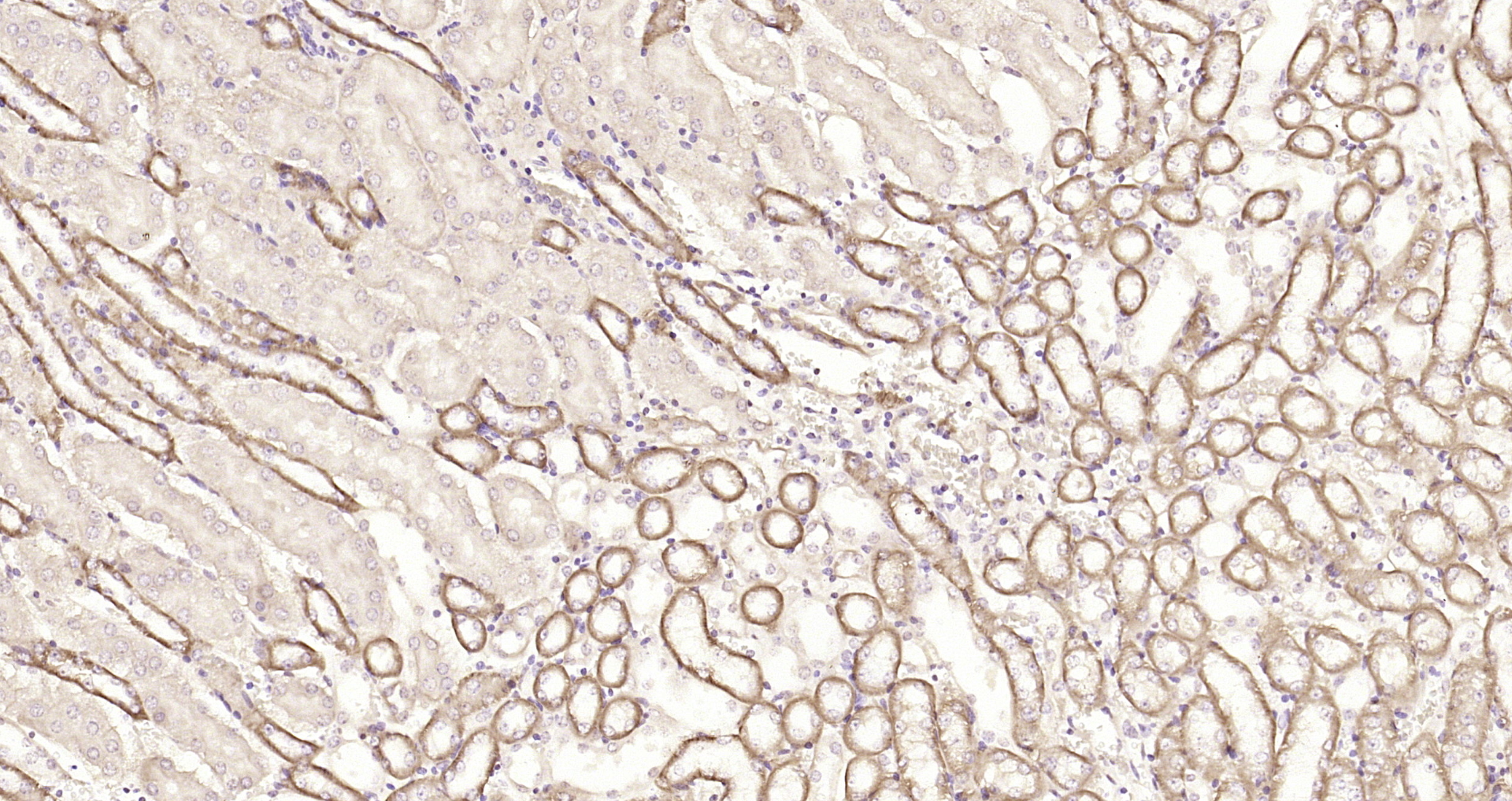 Paraformaldehyde-fixed, paraffin embedded Mouse kidney; Antigen retrieval by boiling in sodium citrate buffer (pH6.0) for 15min; Block endogenous peroxidase by 3% hydrogen peroxide for 20 minutes; Blocking buffer (normal goat serum) at 37°C for 30min; Antibody incubation with MSRB2 Polyclonal Antibody, Unconjugated (bs-17861R) at 1:200 overnight at 4°C, DAB staining.