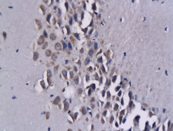 Formalin-fixed and paraffin embedded mouse brain tissue labeled with Anti-CCL17/ABCD2 Polyclonal Antibody, Unconjugated (bs-2453R) followed by conjugation to the secondary antibody