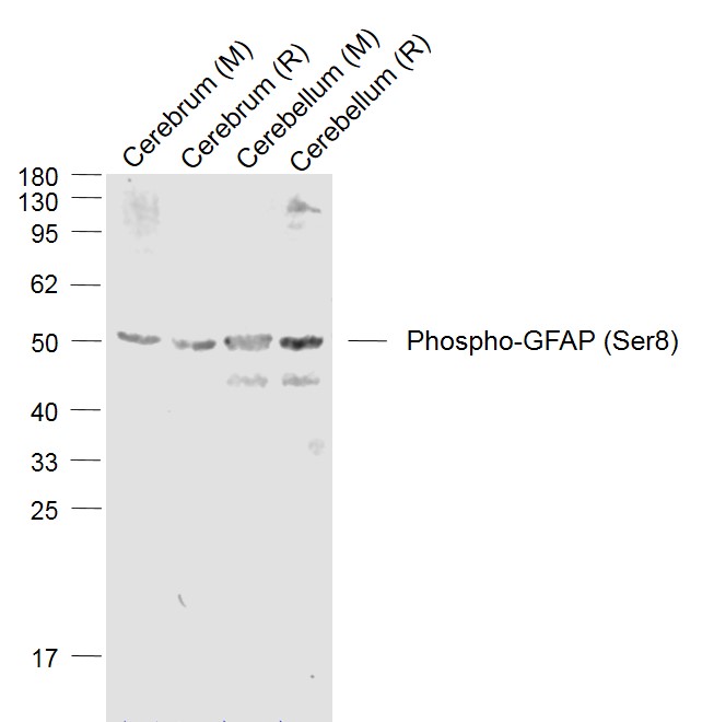 Lane 1: Mouse Cerebrum lysates; Lane 2: Rat Cerebrum lysates; Lane 3: Mouse Cerebellum lysates; Lane 4: Rat Cerebellum lysates probed with phospho-GFAP (Ser8) Polyclonal Antibody, Unconjugated (bs-5355R) at 1:1000 dilution and 4°C overnight incubation. Followed by conjugated secondary antibody incubation at 1:20000 for 60 min at 37°C.