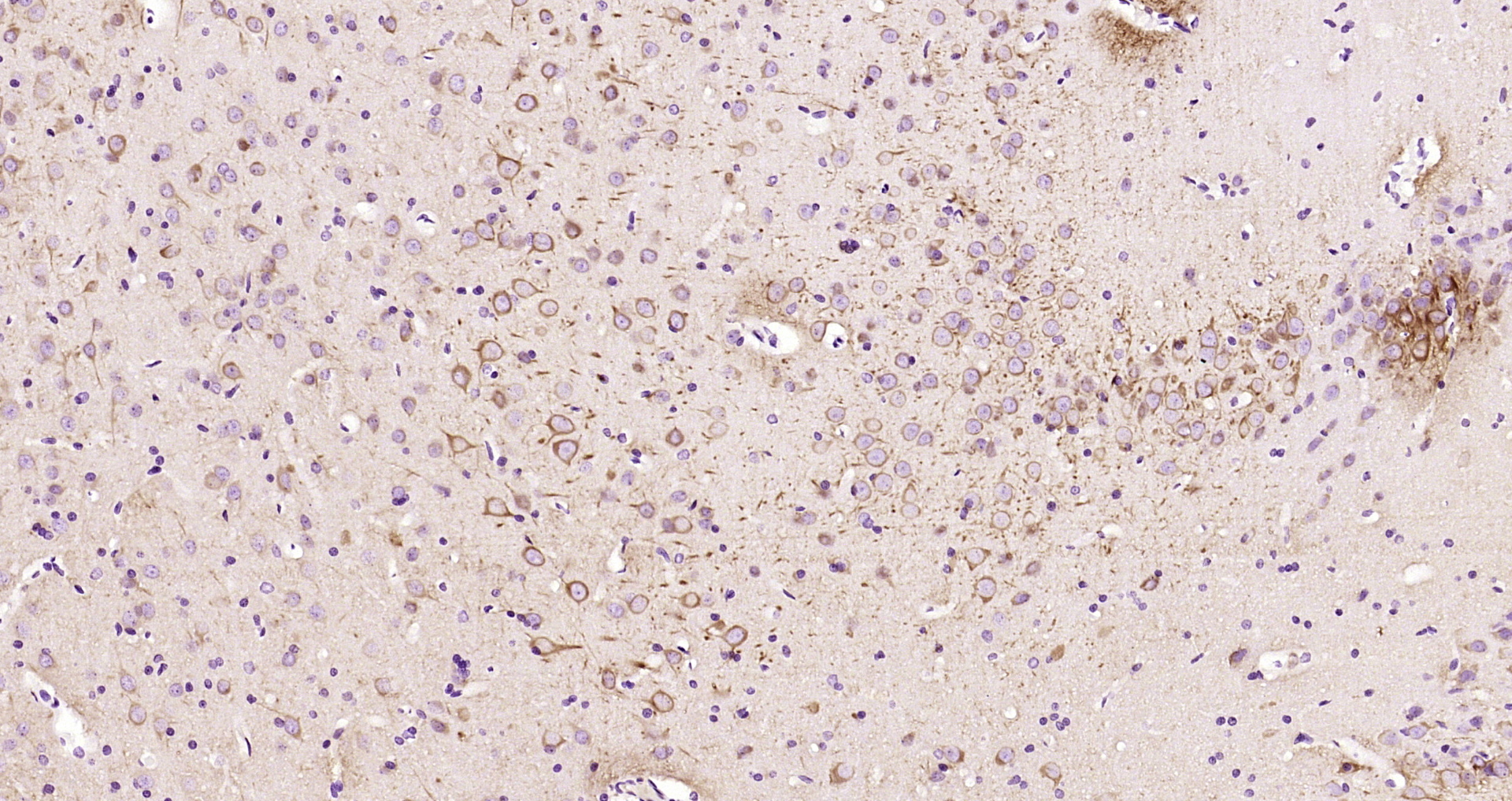 Paraformaldehyde-fixed, paraffin embedded Rat brain; Antigen retrieval by boiling in sodium citrate buffer (pH6.0) for 15min; Block endogenous peroxidase by 3% hydrogen peroxide for 20 minutes; Blocking buffer (normal goat serum) at 37°C for 30min; Antibody incubation with TUBB3 Monoclonal Antibody, Unconjugated (bsm-33177M) at 1:200 overnight at 4°C, DAB staining.