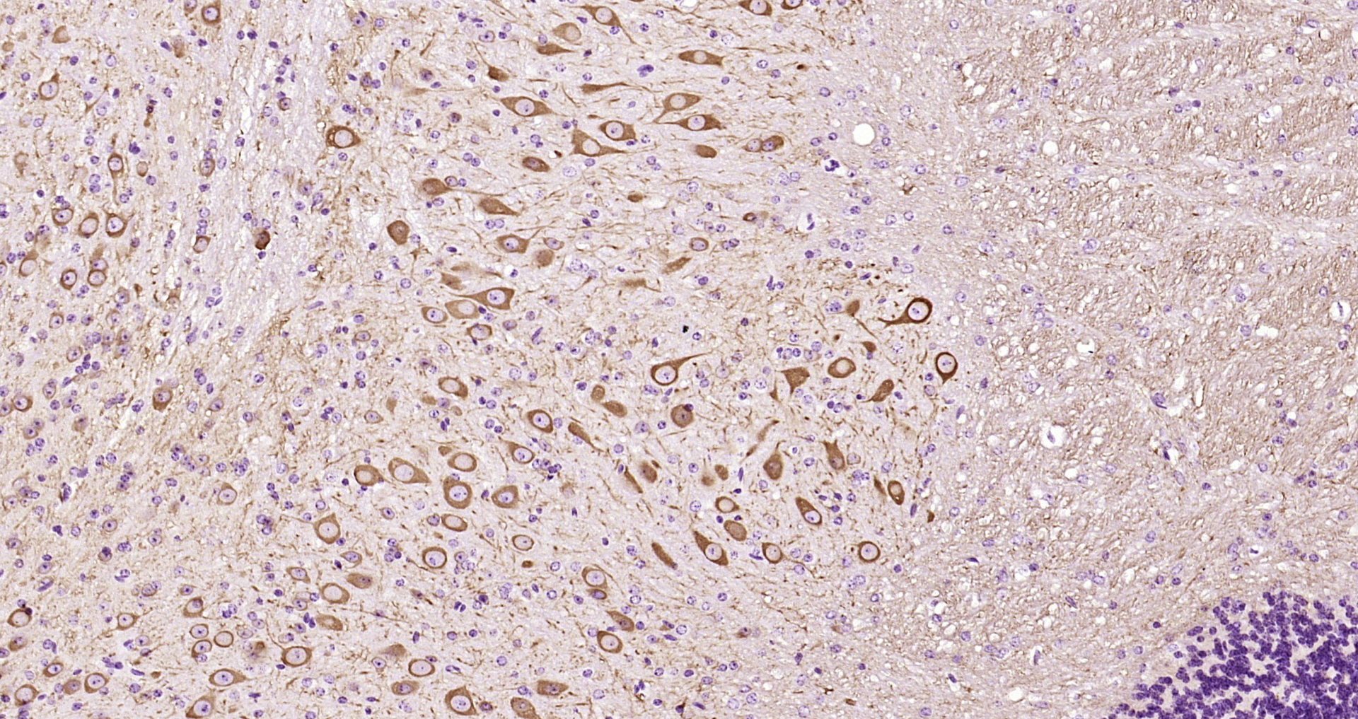 Paraformaldehyde-fixed, paraffin embedded Mouse cerebellum; Antigen retrieval by boiling in sodium citrate buffer (pH6.0) for 15min; Block endogenous peroxidase by 3% hydrogen peroxide for 20 minutes; Blocking buffer (normal goat serum) at 37°C for 30min; Antibody incubation with TUBB3 Monoclonal Antibody, Unconjugated (bsm-33177M) at 1:200 overnight at 4°C, DAB staining.