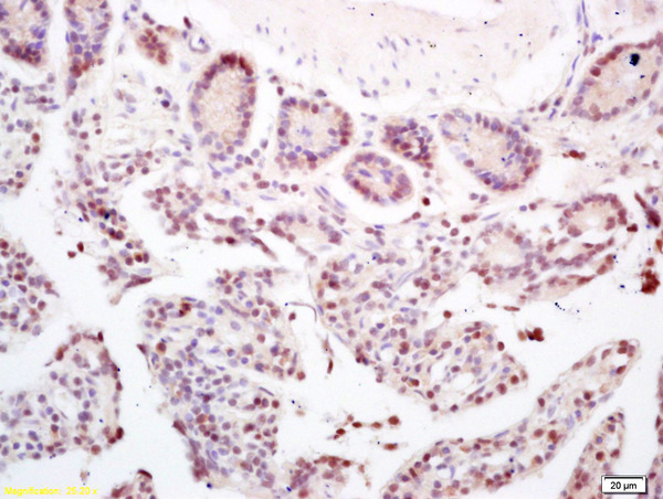 Formalin-fixed and paraffin embedded mouse intestine labeled with Rabbit Anti CCDC7 Polyclonal Antibody, Unconjugated (bs-7991R) at 1:200 followed by conjugation to the secondary antibody and DAB staining