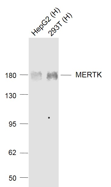 Lane 1: HepG2 cell lysates; Lane 2: 293T cell lysates probed with MERTK Polyclonal Antibody, Unconjugated (bsm-52273R) at 1:1000 dilution and 4˚C overnight incubation. Followed by conjugated secondary antibody incubation at 1:20000 for 60 min at 37˚C._x000D_ _x000D_