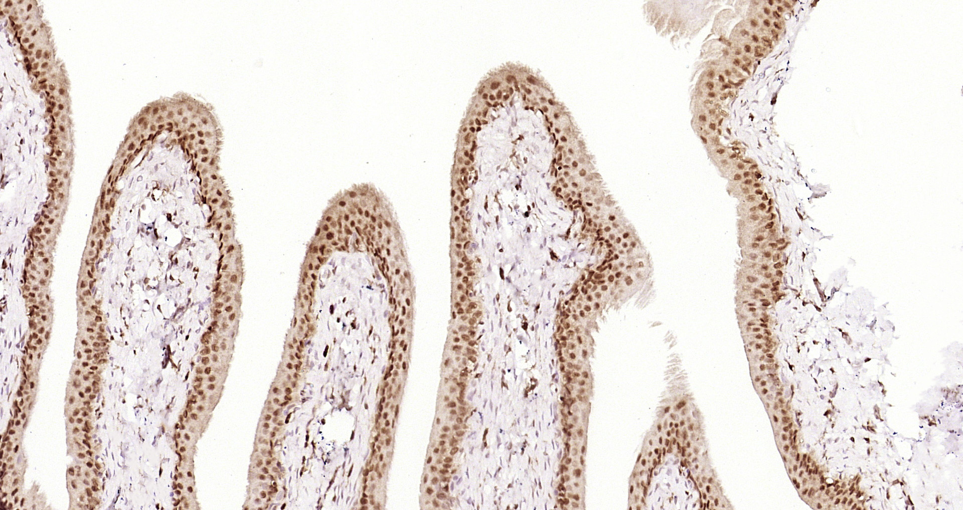 Paraformaldehyde-fixed, paraffin embedded Rat bladder; Antigen retrieval by boiling in sodium citrate buffer (pH6.0) for 15min; Block endogenous peroxidase by 3% hydrogen peroxide for 20 minutes; Blocking buffer (normal goat serum) at 37°C for 30min; Antibody incubation with MSK1 (Ser376) (11A1) Monoclonal Antibody, Unconjugated (bsm-52123R) at 1:200 overnight at 4°C, DAB staining.