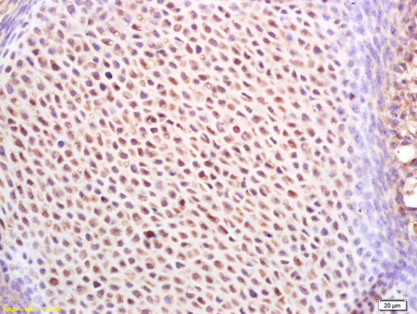 Formalin-fixed and paraffin embedded mouse embryo labeled with Rabbit Anti IGF2BP1/IMP1 Polyclonal Antibody, Unconjugated (bs-5180R) at 1:200 followed by conjugation to the secondary antibody and DAB staining