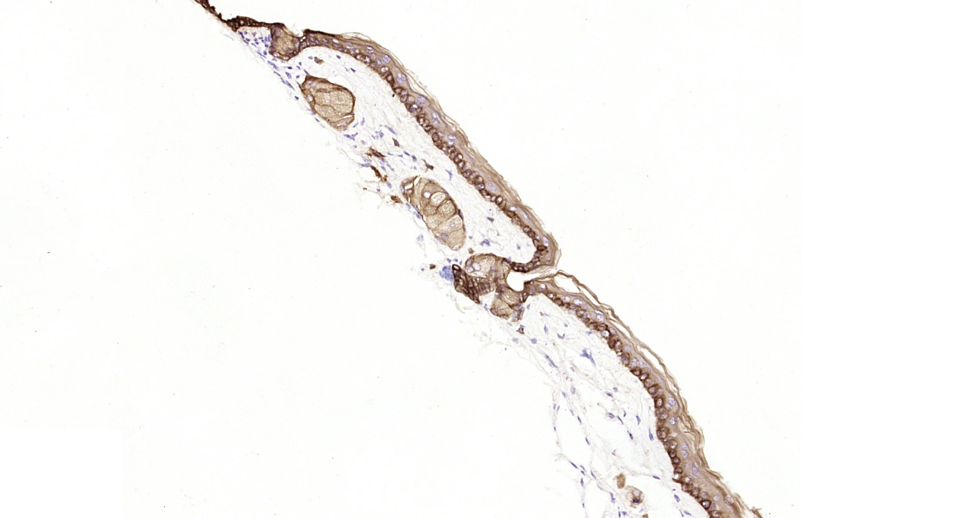 Paraformaldehyde-fixed, paraffin embedded Mouse skin; Antigen retrieval by boiling in sodium citrate buffer (pH6.0) for 15min; Block endogenous peroxidase by 3% hydrogen peroxide for 20 minutes; Blocking buffer (normal goat serum) at 37°C for 30min; Antibody incubation with CK16 Monoclonal Antibody, Unconjugated (bsm-33062M) at 1:800 overnight at 4°C, DAB staining.