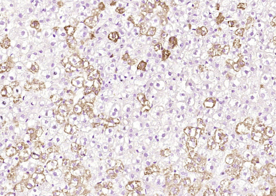 Paraformaldehyde-fixed, paraffin embedded Rat liver; Antigen retrieval by boiling in sodium citrate buffer (pH6.0) for 15min; Block endogenous peroxidase by 3% hydrogen peroxide for 20 minutes; Blocking buffer (normal goat serum) at 37°C for 30min; Antibody incubation with PNMT Polyclonal Antibody, Unconjugated (bs-3912R) at 1:200 overnight at 4°C, DAB staining.