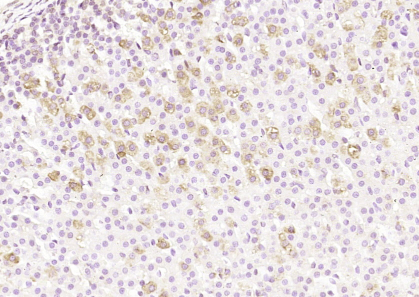 Paraformaldehyde-fixed, paraffin embedded Rat adrenal gland; Antigen retrieval by boiling in sodium citrate buffer (pH6.0) for 15min; Block endogenous peroxidase by 3% hydrogen peroxide for 20 minutes; Blocking buffer (normal goat serum) at 37°C for 30min; Antibody incubation with PNMT Polyclonal Antibody, Unconjugated (bs-3912R) at 1:200 overnight at 4°C, DAB staining.