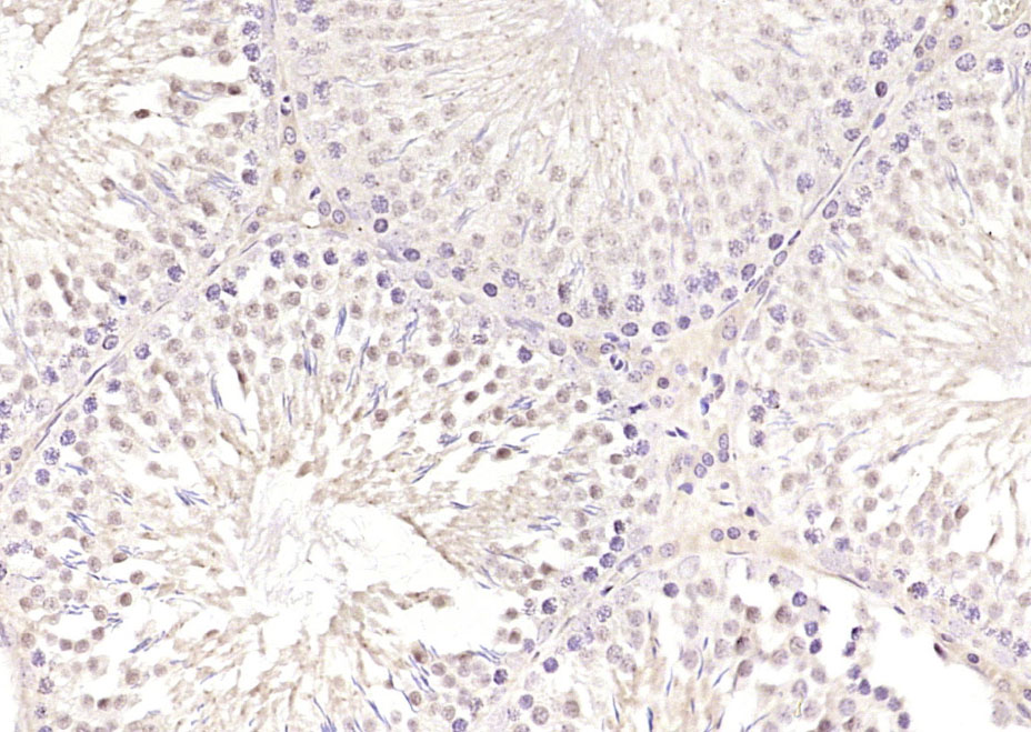 Paraformaldehyde-fixed, paraffin embedded Rat testis; Antigen retrieval by boiling in sodium citrate buffer (pH6.0) for 15min; Block endogenous peroxidase by 3% hydrogen peroxide for 20 minutes; Blocking buffer (normal goat serum) at 37°C for 30min; Antibody incubation with SKA3 Polyclonal Antibody, Unconjugated (bs-7848R) at 1:200 overnight at 4°C, DAB staining.