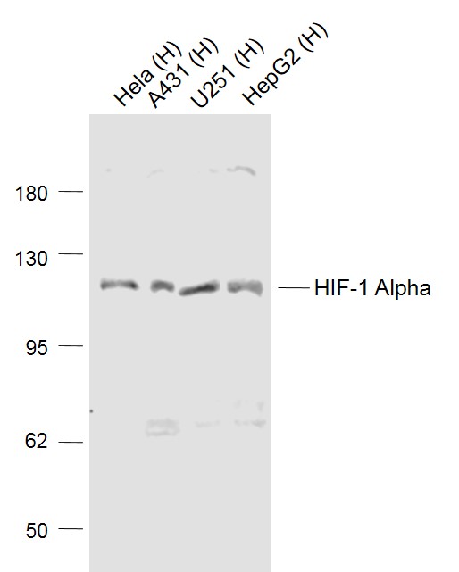 Lane 1: Hela cell lysates; Lane 2: A431 cell lysates; Lane 3: U251 cell lysates; Lane 4: HepG2 cell lysates probed with HIF-1 Alpha Polyclonal Antibody, Unconjugated (bs-0737R) at 1:1000 dilution and 4˚C overnight incubation. Followed by conjugated secondary antibody incubation at 1:20000 for 60 min at 37˚C.