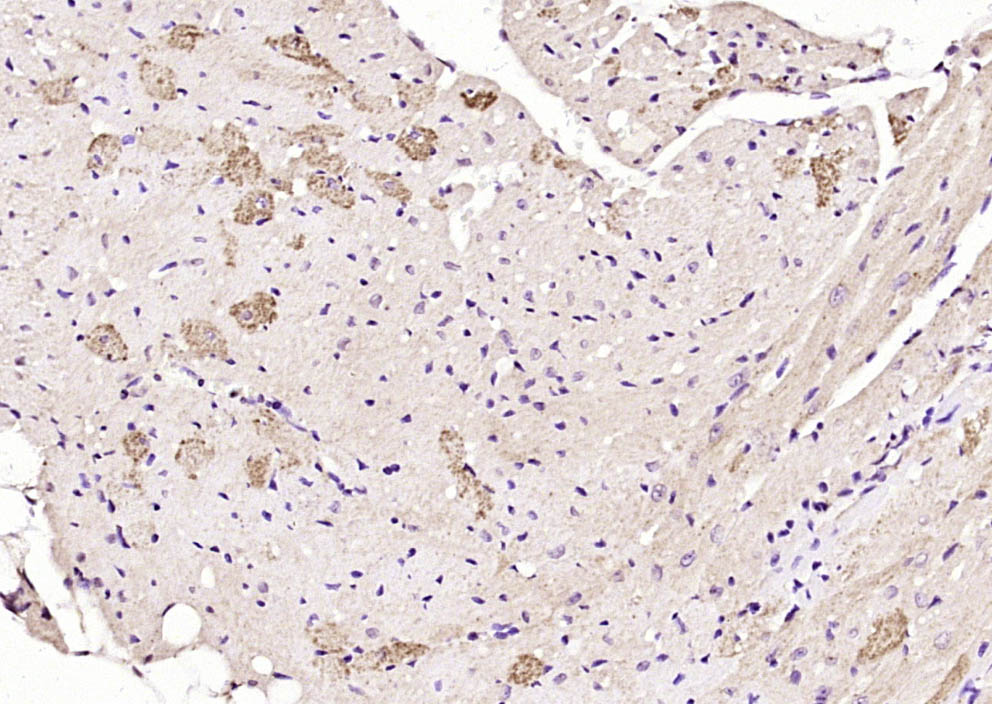 Paraformaldehyde-fixed, paraffin embedded Mouse heart; Antigen retrieval by boiling in sodium citrate buffer (pH6.0) for 15min; Block endogenous peroxidase by 3% hydrogen peroxide for 20 minutes; Blocking buffer (normal goat serum) at 37°C for 30min; Antibody incubation with ITGB1BP2 Polyclonal Antibody, Unconjugated (bs-8013R) at 1:200 overnight at 4°C, DAB staining. Paraformaldehyde-fixed, paraffin embedded Mouse heart; Antigen retrieval by boiling in sodium citrate buffer (pH6.0) for 15min; Block endogenous peroxidase by 3% hydrogen peroxide for 20 minutes; Blocking buffer (normal goat serum) at 37°C for 30min; Antibody incubation with ITGB1BP2 Polyclonal Antibody, Unconjugated (bs-8013R) at 1:200 overnight at 4°C, DAB staining.