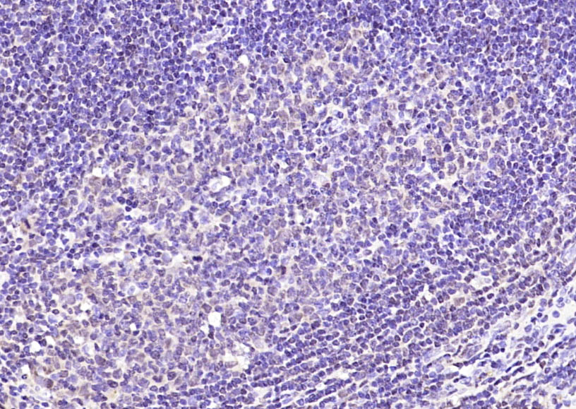 Paraformaldehyde-fixed, paraffin embedded Human tonsil; Antigen retrieval by boiling in sodium citrate buffer (pH6.0) for 15min; Block endogenous peroxidase by 3% hydrogen peroxide for 20 minutes; Blocking buffer (normal goat serum) at 37°C for 30min; Antibody incubation with NFATC4 (Ser168 + Ser170) Polyclonal Antibody, Unconjugated (bs-8535R) at 1:200 overnight at 4°C, DAB staining.