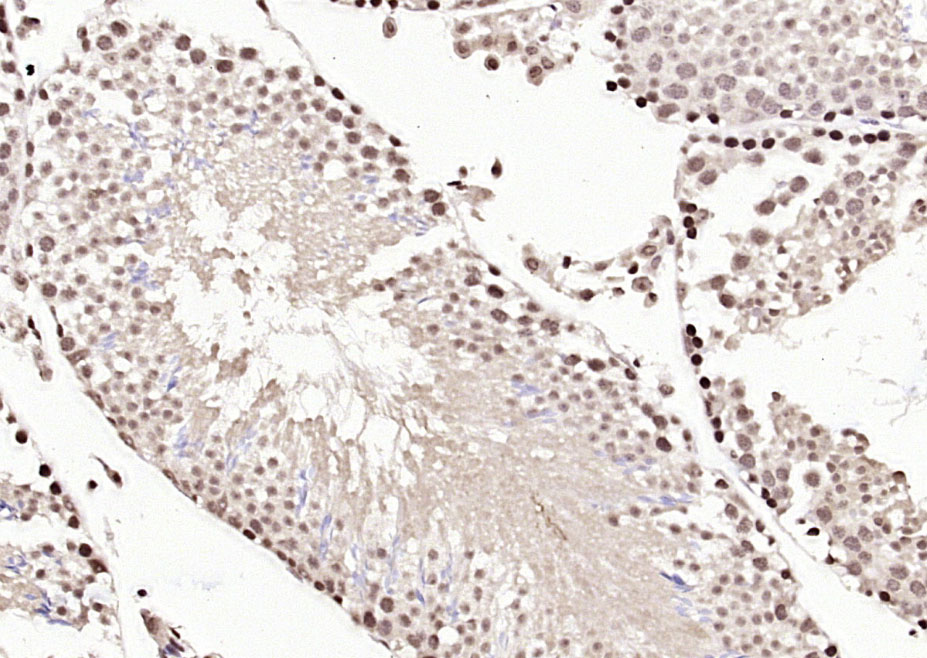 Paraformaldehyde-fixed, paraffin embedded Mouse testis; Antigen retrieval by boiling in sodium citrate buffer (pH6.0) for 15min; Block endogenous peroxidase by 3% hydrogen peroxide for 20 minutes; Blocking buffer (normal goat serum) at 37°C for 30min; Antibody incubation with NFATC4 (Ser168 + Ser170) Polyclonal Antibody, Unconjugated (bs-8535R) at 1:200 overnight at 4°C, DAB staining.