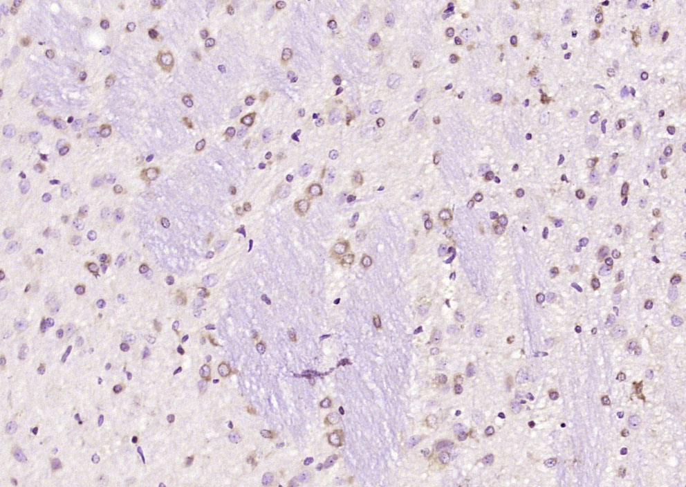 Paraformaldehyde-fixed, paraffin embedded Rat brain; Antigen retrieval by boiling in sodium citrate buffer (pH6.0) for 15min; Block endogenous peroxidase by 3% hydrogen peroxide for 20 minutes; Blocking buffer (normal goat serum) at 37°C for 30min; Antibody incubation with PDZK4 Polyclonal Antibody, Unconjugated (bs-9038R) at 1:200 overnight at 4°C, DAB staining.
