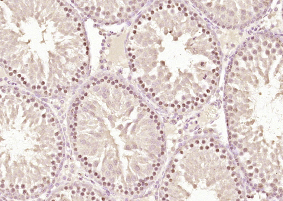 Paraformaldehyde-fixed, paraffin embedded Rat testis; Antigen retrieval by boiling in sodium citrate buffer (pH6.0) for 15min; Block endogenous peroxidase by 3% hydrogen peroxide for 20 minutes; Blocking buffer (normal goat serum) at 37°C for 30min; Antibody incubation with ZNF575 Polyclonal Antibody, Unconjugated (bs-13588R) at 1:200 overnight at 4°C, DAB staining.
