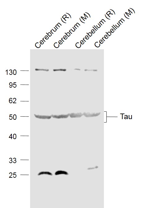 Lane 1: Rat Cerebrum lysates; Lane 2: Mouse Cerebrum lysates; Lane 3: Rat Cerebellum lysates; Lane 4: Mouse Cerebellum lysates probed with Tau Polyclonal Antibody, Unconjugated (bs-0157R) at 1:1000 dilution and 4˚C overnight incubation. Followed by conjugated secondary antibody incubation at 1:20000 for 60 min at 37˚C._x000D_ _x000D_