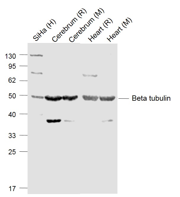 Lane 1: SiHa cell lysates; Lane 2: Rat Cerebrum lysates; Lane 3: Mouse Cerebrum lysates; Lane 4: Rat Heart lysates ; Lane 5: Mouse Heart lysates probed with Beta tubulin Polyclonal Antibody, Unconjugated (bs-4511R) at 1:1000 dilution and 4˚C overnight incubation. Followed by conjugated secondary antibody incubation at 1:20000 for 60 min at 37˚C._x000D_ _x000D_