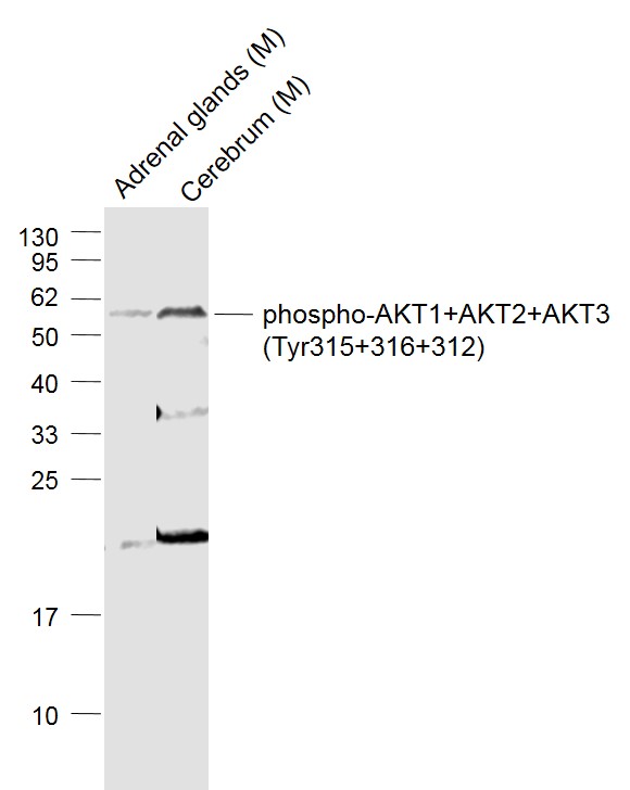 Lane 1: Mouse Adrenal glands lysates; Lane 2: Mouse Cerebrum lysates probed with phospho-AKT1+AKT2+AKT3 (Tyr315+316+312) Polyclonal Antibody, Unconjugated (bs-5193R) at 1:1000 dilution and 4˚C overnight incubation. Followed by conjugated secondary antibody incubation at 1:20000 for 60 min at 37˚C._x000D_ _x000D_