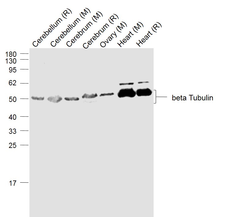 Lane 1: Mouse Cerebellum Lysate;Lane 2: Rat Cerebellum Lysate;Lane 3: Mouse Cerebrum Lysate;Lane 4: Rat Cerebrum Lysate;Lane 5:Mouse Ovary Lysate;Lane 6:Mouse Heart Lysate;Lane 7: Rat Heart Lysate probed with beta Tubulin Polyclonal Antibody, Unconjugated (bs-0210R) at 1:1000 dilution and 4˚C overnight incubation. Followed by conjugated secondary antibody incubation at 1:20000 for 60 min at 37˚C