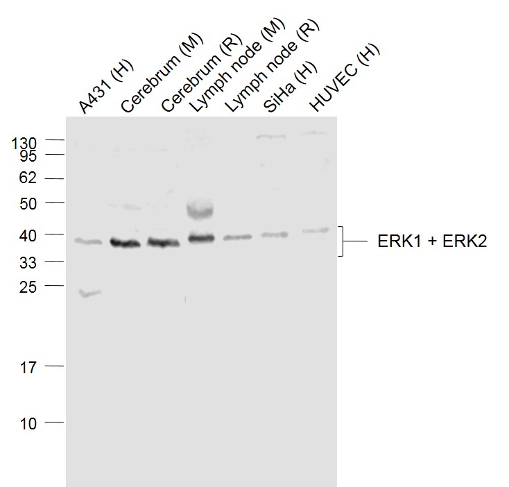 Lane 1: A431 cell Lysate;Lane 2: Mouse Cerebrum Lysate;Lane 3: Rat Cerebrum Lysate;Lane 4: Mouse Lymph node Lysate;Lane 5: Rat Lymph node Lysate;Lane 6: SiHa cell Lysate;Lane 7: HUVEC cell Lysate probed with ERK1 + ERK2 Polyclonal Antibody, Unconjugated (bs-2637R) at 1:1000 dilution and 4˚C overnight incubation. Followed by conjugated secondary antibody incubation at 1:20000 for 60 min at 37˚C_x000D_ _x000D_