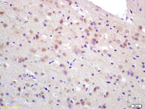 Formalin-fixed and paraffin embedded rat brain labeled with Rabbit Anti CCDC12 Polyclonal Antibody, Unconjugated (bs-8104R) at 1:200 followed by conjugation to the secondary antibody and DAB staining