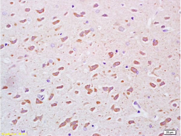 Formalin-fixed and paraffin embedded rat brain tissue labeled Anti-PEGF Polyclonal Antibody, Unconjugated (bs-0731R) at 1:200, followed by conjugation to the secondary antibody and DAB staining